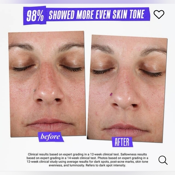 Kiehl’s • Clearly Corrective Dark Spot Solution - Picture 3 of 6